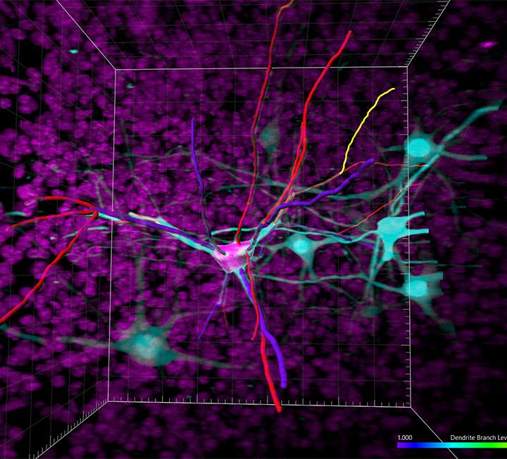 Imaris D D Image Visualization Analysis With Deconvolution