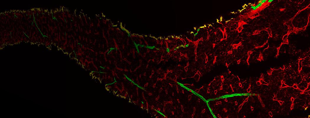 Microscopy Image Analysis Software - Imaris - Oxford Instruments