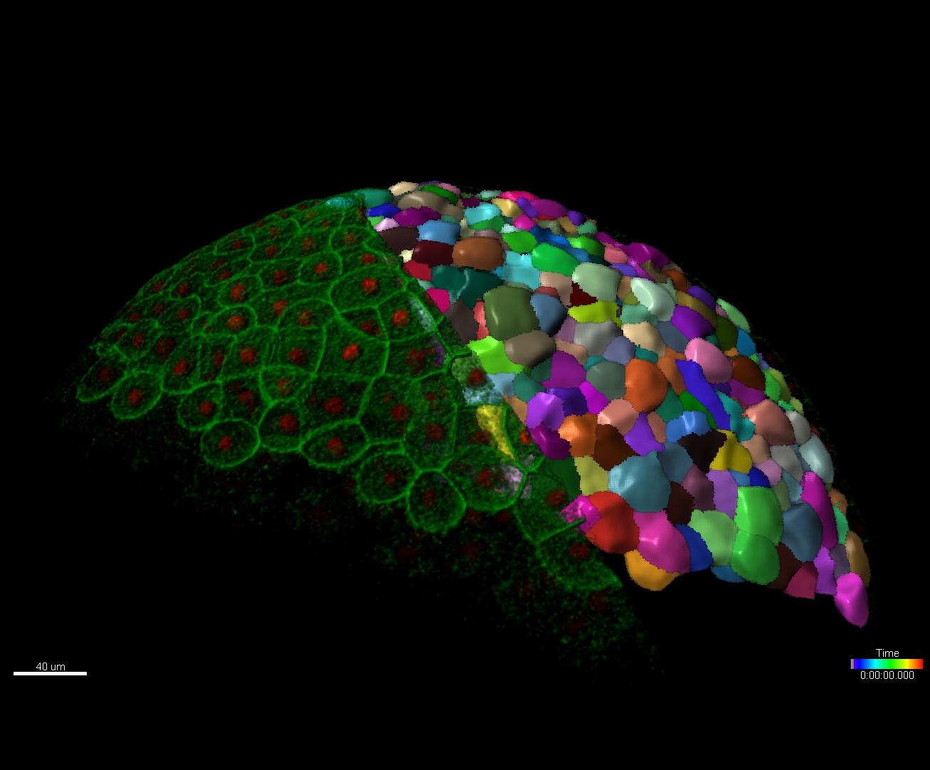 The ‚Biofilm Analysis‚ XTension measures the mean thickness, maximum thickness and Roughness Coefficient (Variance) of all reconstructed objects in the Surfaces scene.