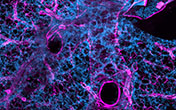 Imaris for Cancer Research