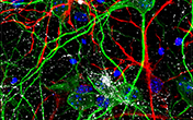 Imaris for Neuroscientists